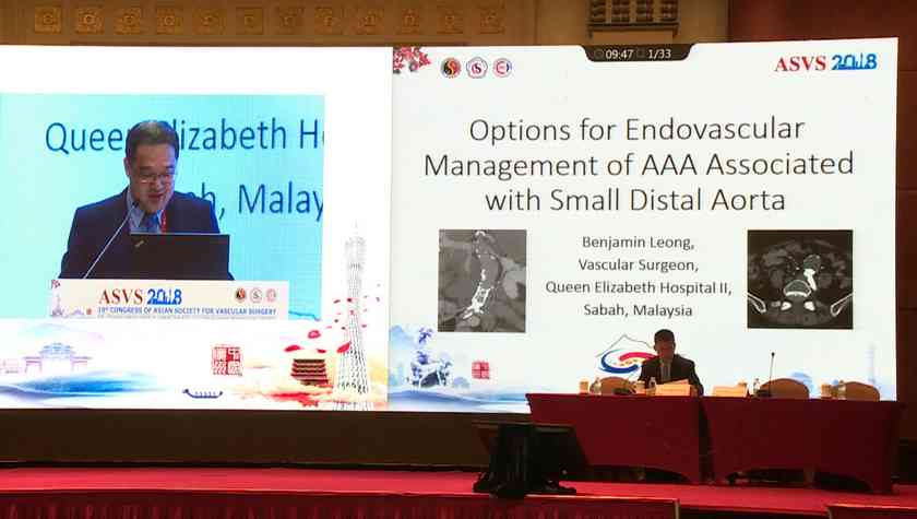 Benjamin Leong：Options for Endovascular Management of AAA Associated With Small Distal Aorta